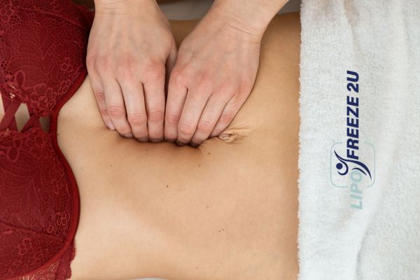 diastasis recti treatment Chesterfield