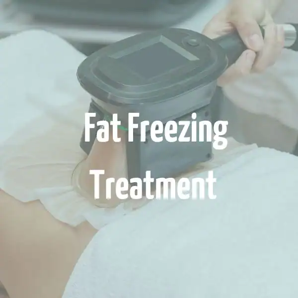 fat freezing treatment Chesterfield