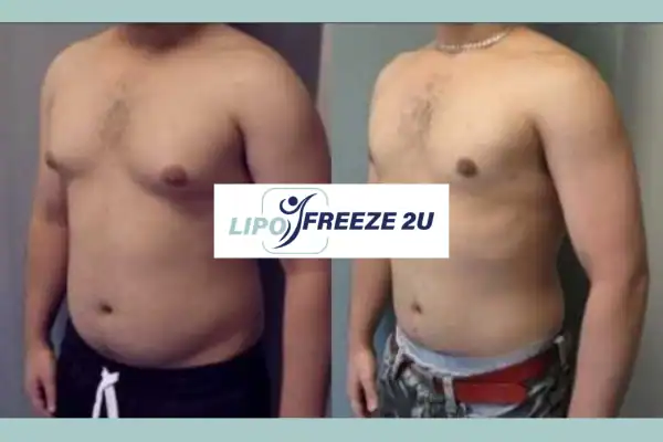 How Long Does It Take to See Results Chesterfield?