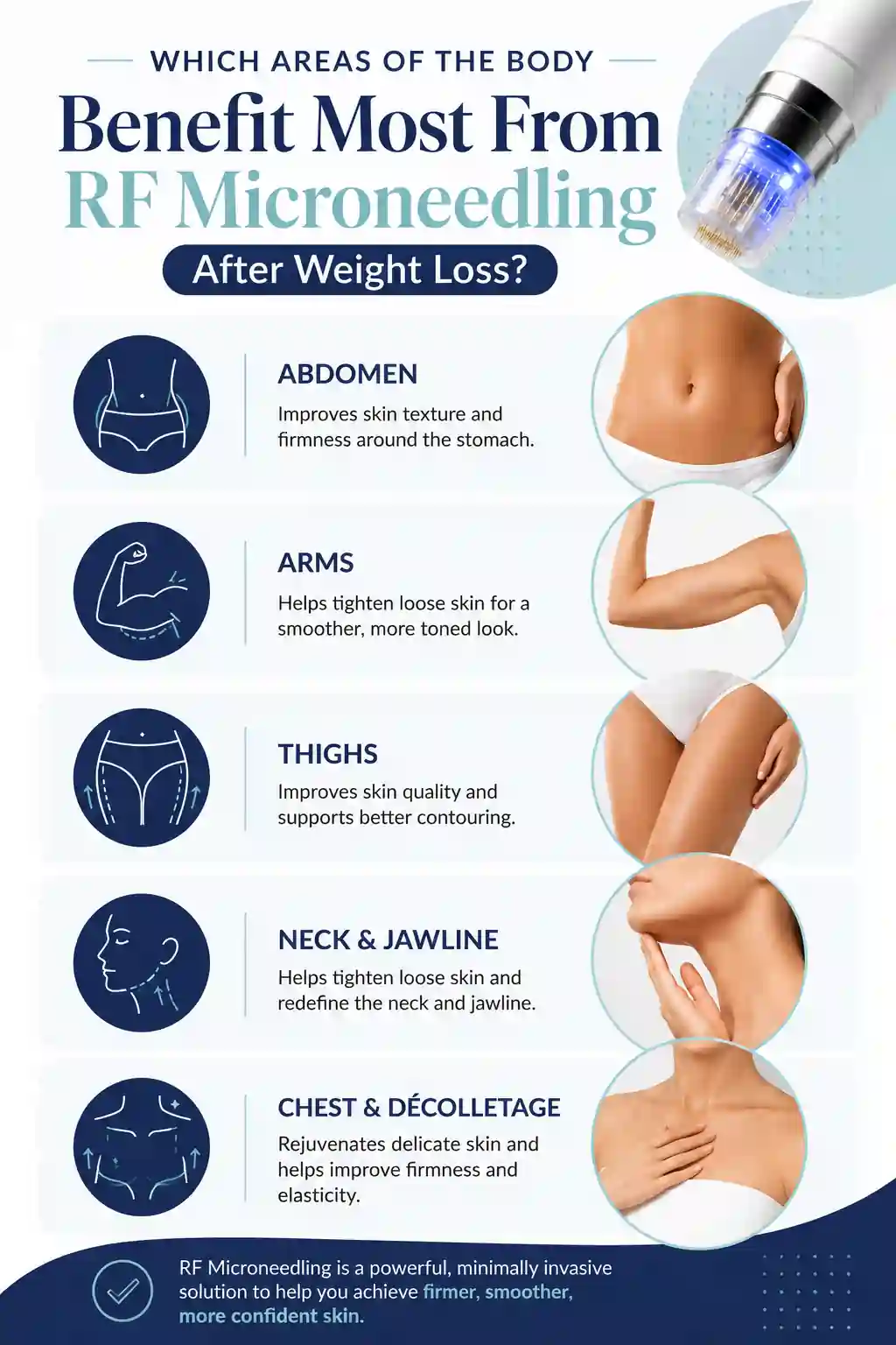 Which Areas of the Body Benefit Most From RF Microneedling After Weight Loss Chesterfield